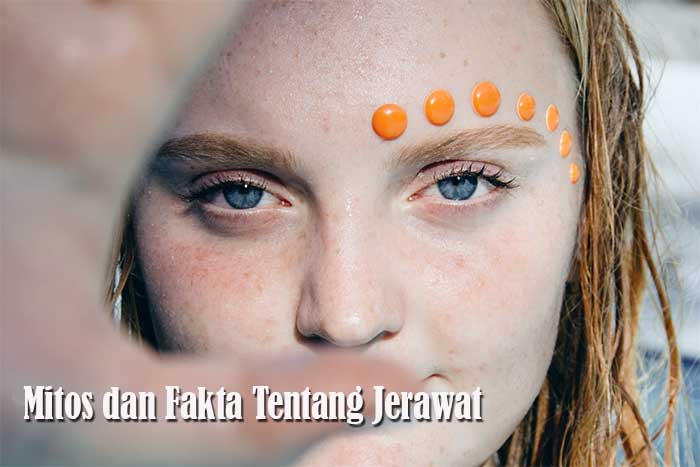 Mitos dan Fakta Tentang Jerawat